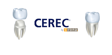 Cerec Crowns Image